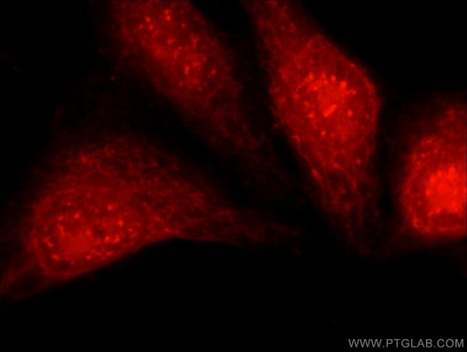 [13763-1-AP-20UL] PFKFB3-Specific Polyclonal antibody