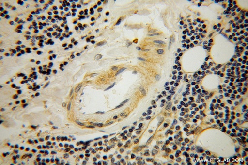 [13764-1-AP-20UL] STXBP3 Polyclonal antibody