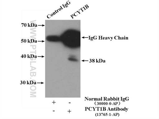 [13765-1-AP-150UL] PCYT1B Polyclonal antibody