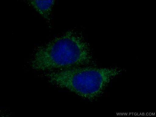 [13766-1-AP-20UL] Entactin Polyclonal antibody