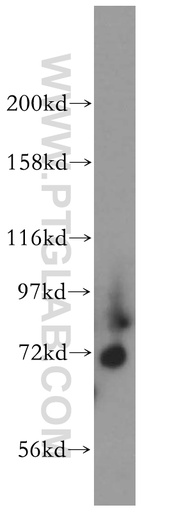 [13768-1-AP-150UL] Kv4.1 Polyclonal antibody
