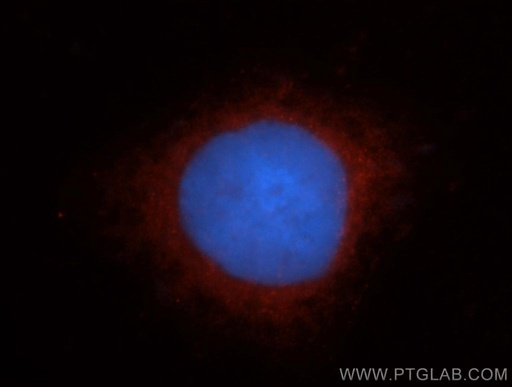 [13770-1-AP-20UL] TRAK2 Polyclonal antibody