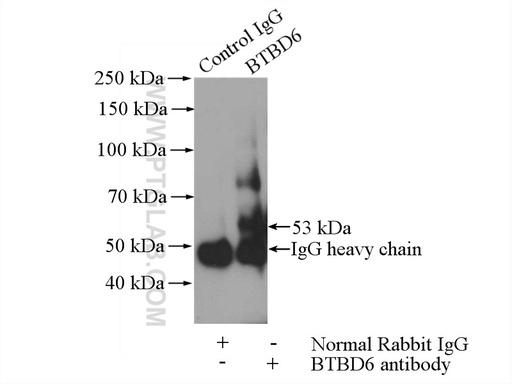 [13776-1-AP-150UL] BTBD6 Polyclonal antibody
