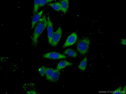 [13779-1-AP-150UL] DZIP1 Polyclonal antibody