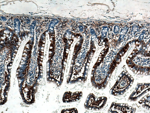 [13781-1-AP-150UL] FABP6 Polyclonal antibody