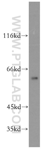 [13782-1-AP-150UL] CPNE6 Polyclonal antibody