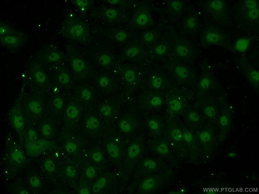 [13787-1-AP-20UL] EAF1 Polyclonal antibody
