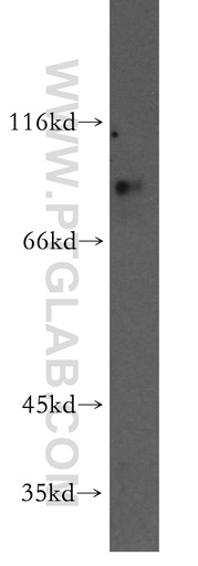 [13792-1-AP-20UL] PRDM4 Polyclonal antibody