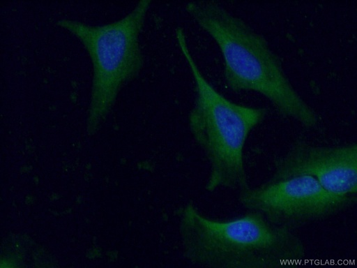 [13795-1-AP-20UL] GAS6 Polyclonal antibody