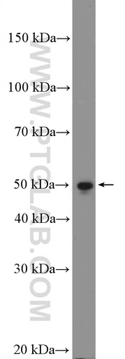 [13796-1-AP-150UL] WBSCR16 Polyclonal antibody
