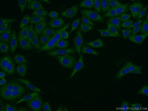 [13797-1-AP-150UL] Pentraxin 3 Polyclonal antibody