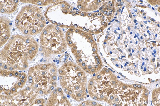 [13798-1-AP-150UL] MFN1 Polyclonal antibody