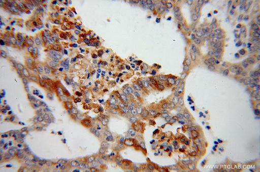 [13799-1-AP-150UL] PARN Polyclonal antibody
