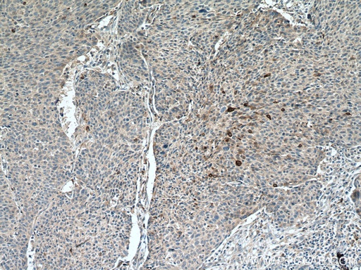 [13801-1-AP-20UL] PAI-1 Polyclonal antibody