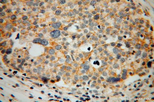 [13802-1-AP-20UL] CORO2B Polyclonal antibody