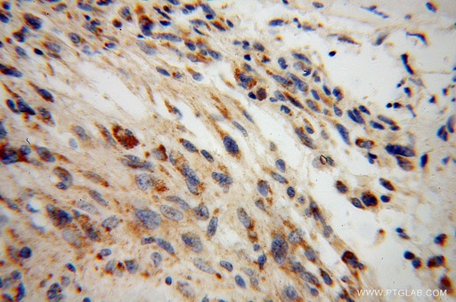 [13807-1-AP-20UL] DARS2 Polyclonal antibody
