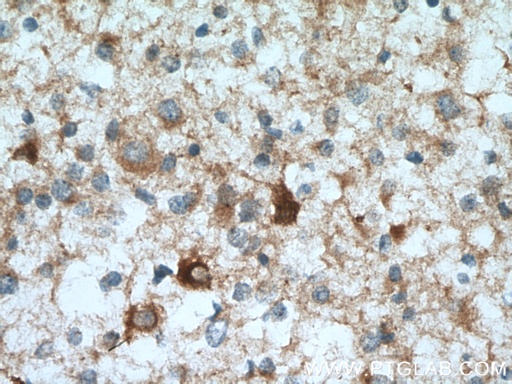 [13808-1-AP-150UL] DYNC1I1 Polyclonal antibody