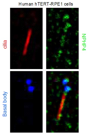 [13812-1-AP-150UL] NPHP4 Polyclonal antibody