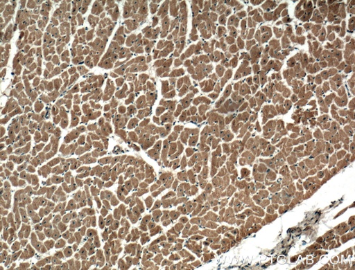 [13816-1-AP-20UL] DIXDC1 Polyclonal antibody