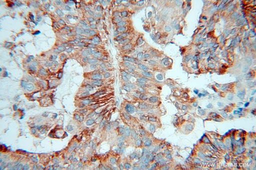 [13821-1-AP-20UL] ARTS1 Polyclonal antibody