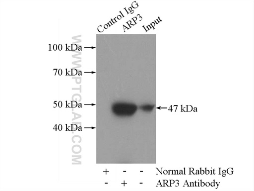[13822-1-AP-150UL] ARP3/ARP3B Polyclonal antibody