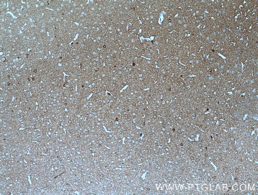 [13828-1-AP-20UL] ATP6V0A1 Polyclonal antibody