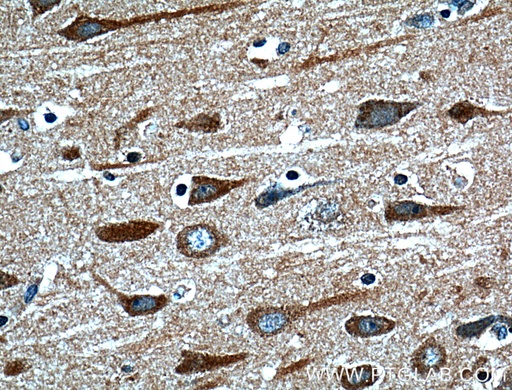[13830-1-AP-20UL] HTR7 Polyclonal antibody