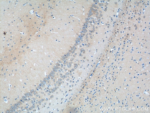 [13831-1-AP-150UL] GLRA2 Polyclonal antibody