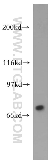 [13833-1-AP-150UL] TIGD1 Polyclonal antibody
