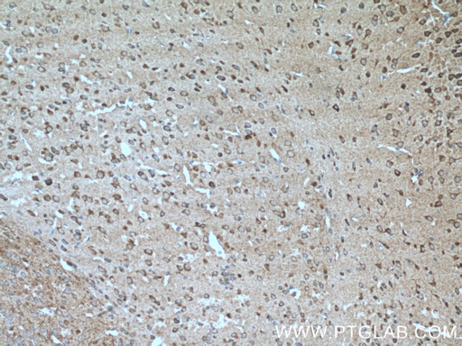 [13839-1-AP-20UL] TAC1 Polyclonal antibody