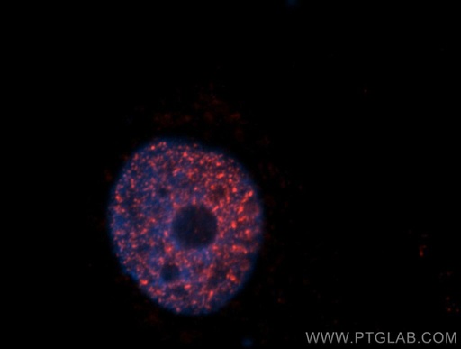 [13841-1-AP-20UL] SAP18 Polyclonal antibody