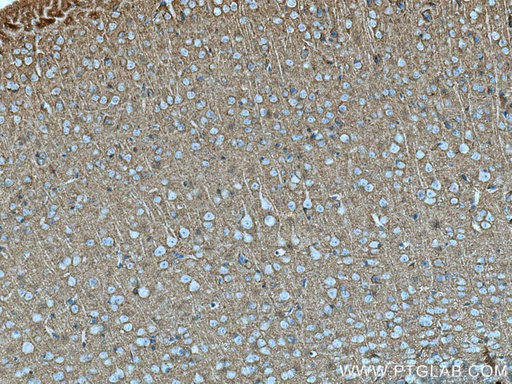 [13843-1-AP-150UL] CNTN1 Polyclonal antibody