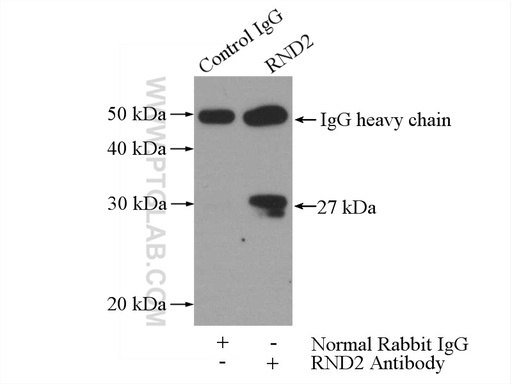 [13844-1-AP-150UL] RND2 Polyclonal antibody