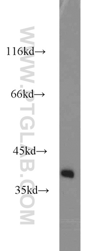 [13849-1-AP-20UL] SH3GL3 Polyclonal antibody