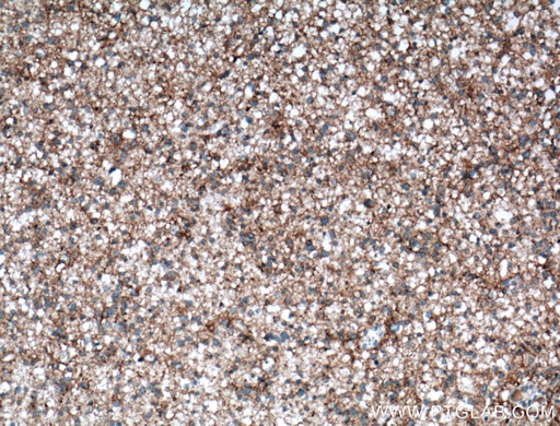 [13850-1-AP-150UL] NCAM2 Polyclonal antibody