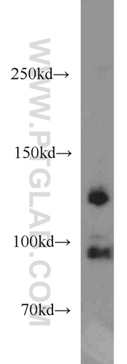 [13851-1-AP-150UL] CYTSB Polyclonal antibody