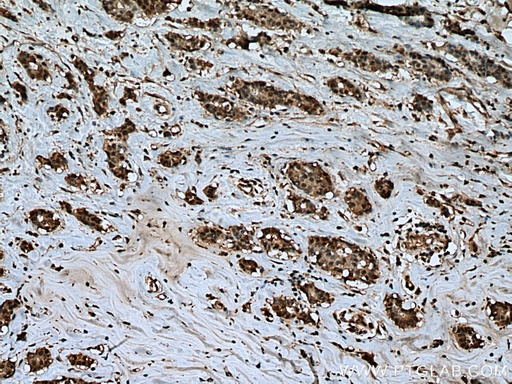 [13856-1-AP-150UL] UBP1 Polyclonal antibody