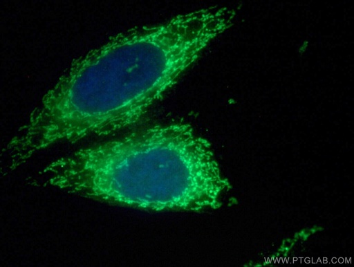[13859-1-AP-20UL] TIMM44 Polyclonal antibody