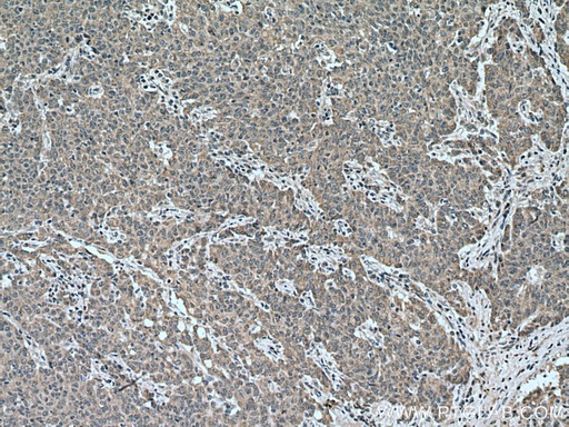 [13861-1-AP-20UL] CCPG1 Polyclonal antibody
