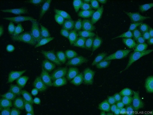 [13862-1-AP-150UL] TACC1 Polyclonal antibody