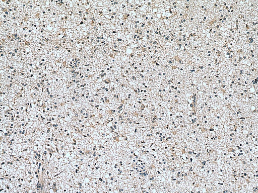[13865-1-AP-20UL] Frizzled 9 Polyclonal antibody