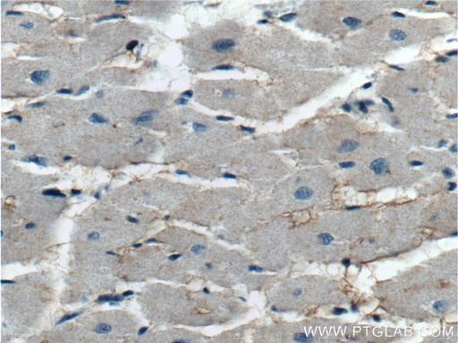 [13867-1-AP-150UL] KCNE1L Polyclonal antibody
