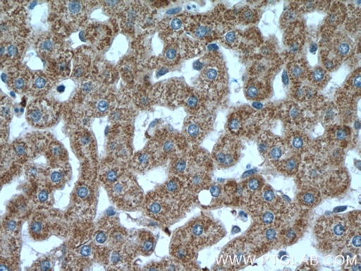 [13869-1-AP-150UL] VPS41 Polyclonal antibody