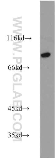 [13870-1-AP-150UL] Calpain 7 Polyclonal antibody