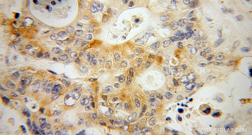 [13871-1-AP-150UL] KBTBD2 Polyclonal antibody