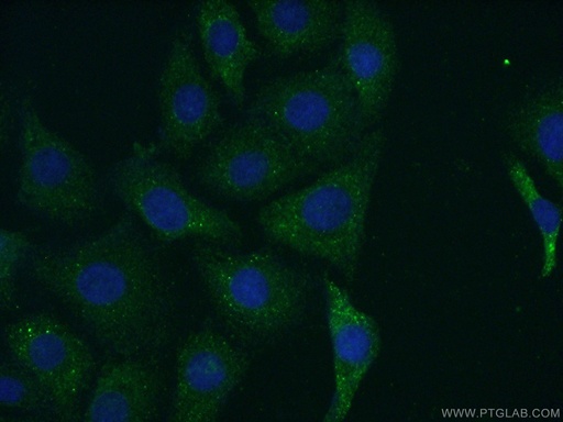 [13873-1-AP-150UL] DGKH Polyclonal antibody