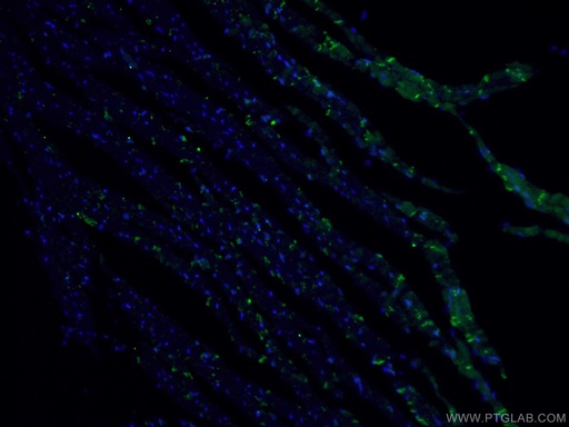 [13876-1-AP-150UL] Desmocollin 2 Polyclonal antibody