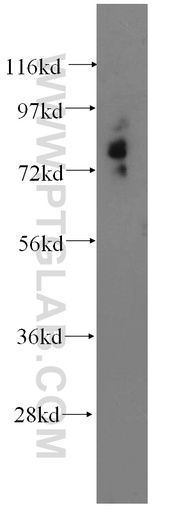 [13879-1-AP-150UL] Mucolipin 3 Polyclonal antibody