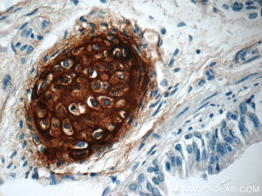 [13880-1-AP-20UL] Aggrecan Polyclonal antibody