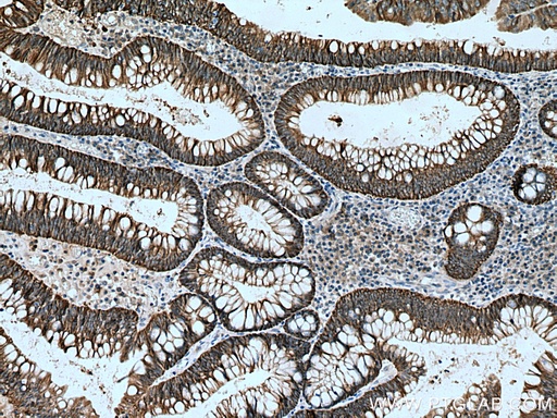 [13884-1-AP-20UL] NKCC1 Polyclonal antibody
